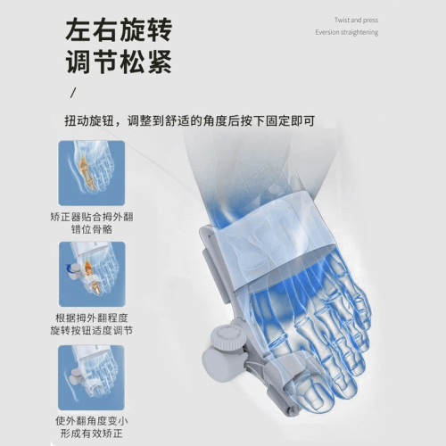 旋鈕大拇指外翻腳趾矯正器大腳骨重曡分趾器母趾頭分離器可調節
